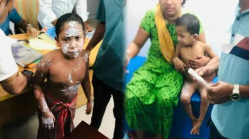 নোয়াখালীতে গ্যাস লিকেজ থেকে বিস্ফোরণ, নারী-শিশুসহ এক পরিবারে দগ্ধ ৪