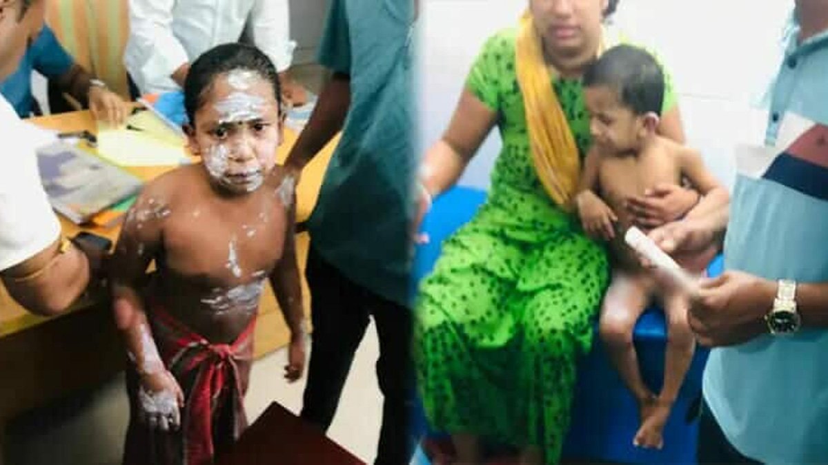 নোয়াখালীতে গ্যাস লিকেজ থেকে বিস্ফোরণ, নারী-শিশুসহ এক পরিবারে দগ্ধ ৪